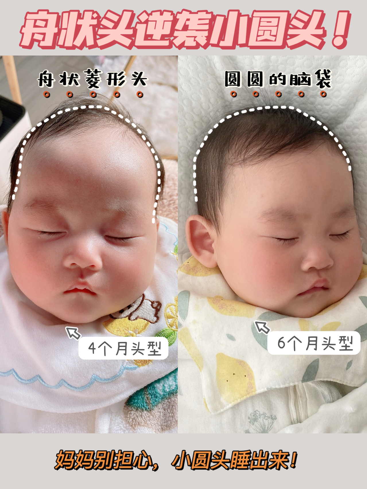 成功逆襲！盤狀頭睡出小圓頭，只需要這樣做！